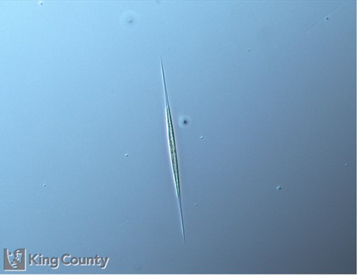 Photo of Nitzschia acicularis